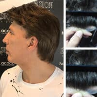 Prótesis Stock Parcial Masculina en Encaje Suizo (Cabello Indio)