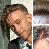 Prótesis capilar para hombre adhesiva (Cabello Europeo)