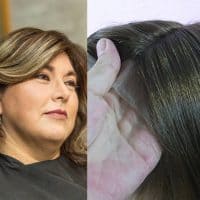 Top Closure indicada para cubrir la Alopecia Androge