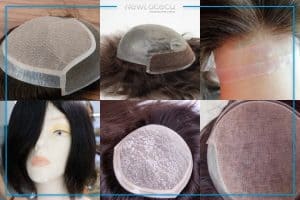 Prótesis del cabello