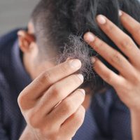 condiciones médicas que causan la caída del cabello