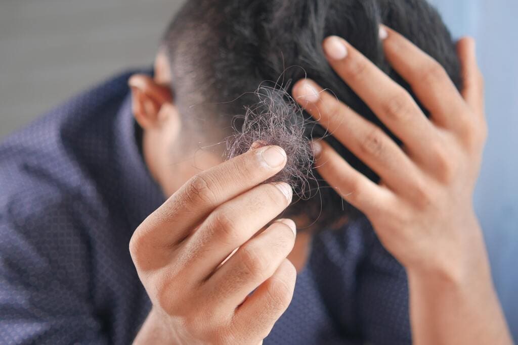 Tratamiento láser para la caída del cabello