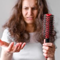 tipos de alopecia en mujeres